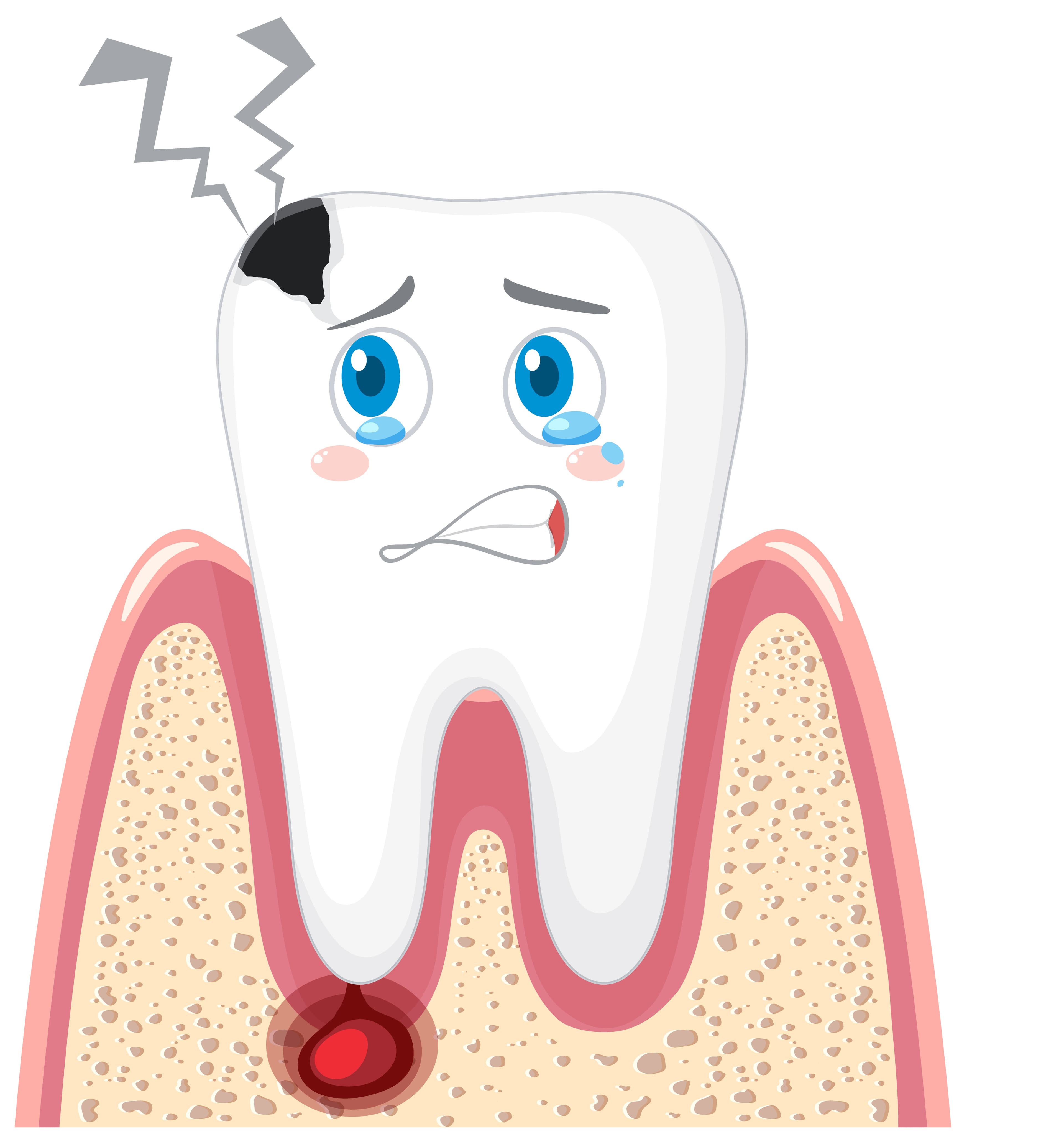 Root Canal Therapy β Pain-Free & Efficient