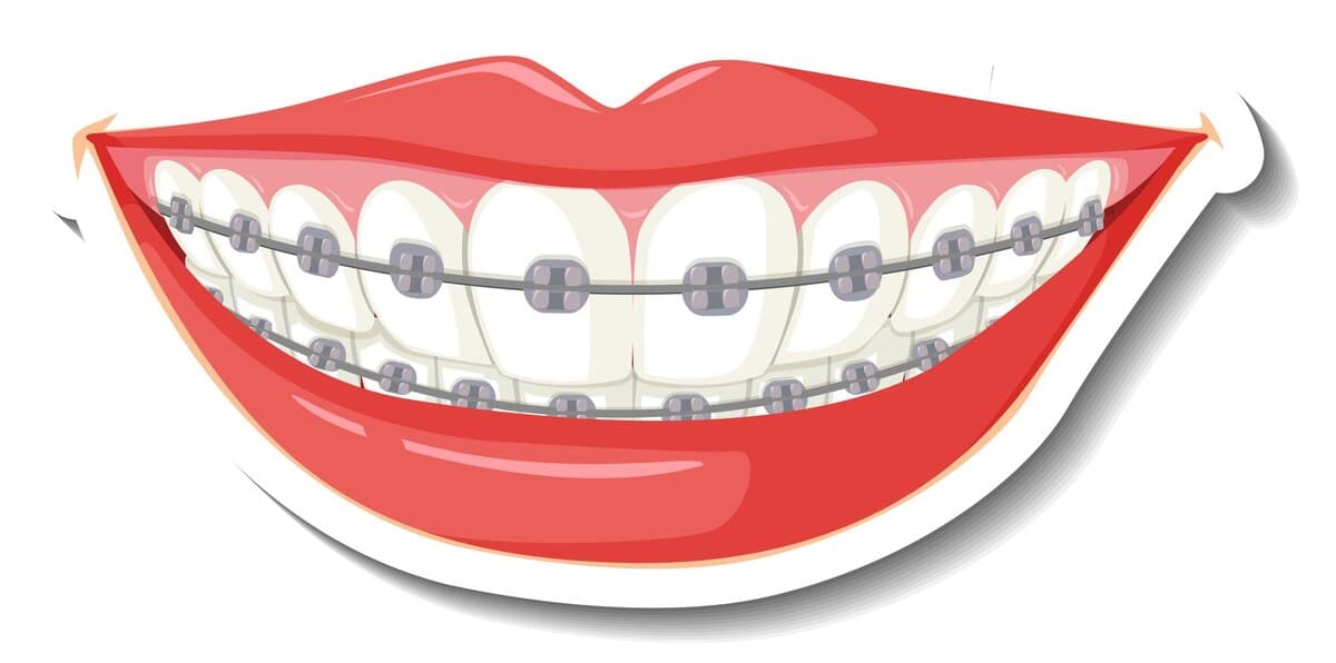 Orthodontics β Braces & Clear Aligners